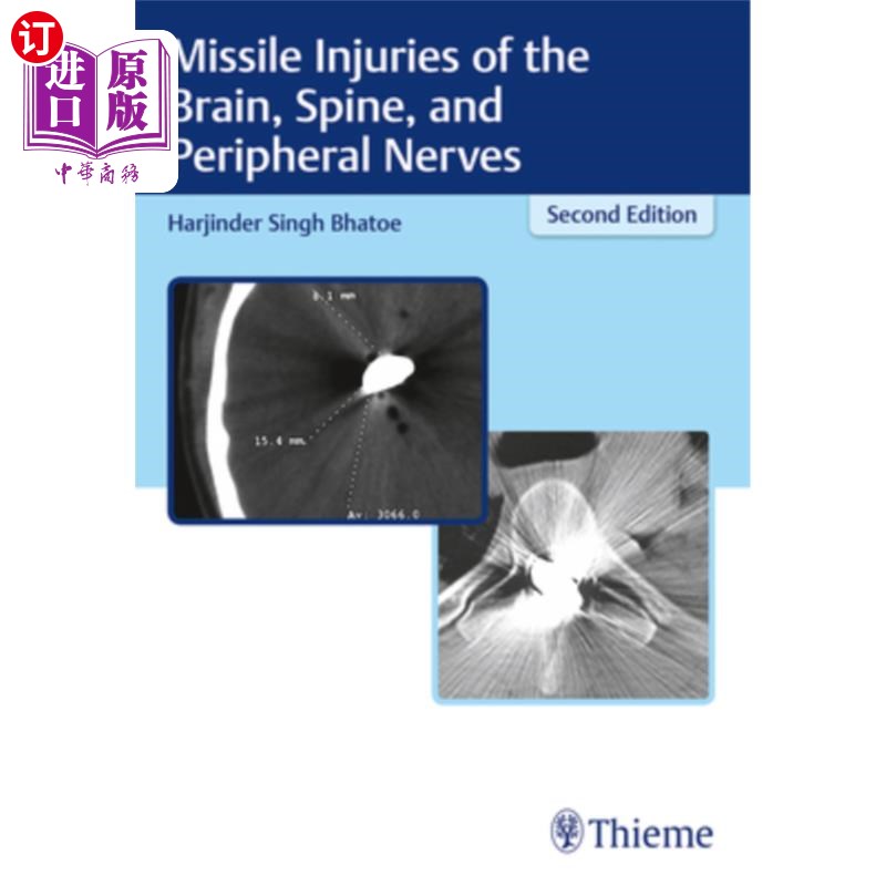 海外直订医药图书Missile Injuries of the Brain, Spine, and Peripheral Nerves 脑、脊柱和周围神经的飞弹损伤