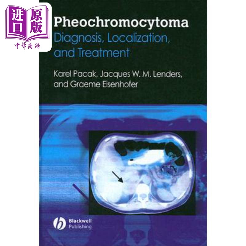 现货 嗜铬细胞瘤 诊断 局部化与治疗 Pheochromocytoma 英文原版 Karel Pacak 中商原版