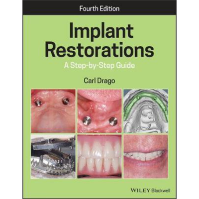 现货 植入物修复 分步指南 Implant Restorations 英文原版 Carl Drago 中商原版