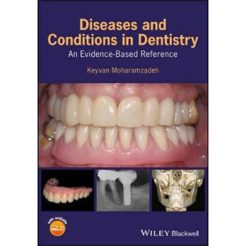现货 牙科疾病与病症 循证参考文献 Diseases And Conditions In Dentistry 英文原版 Keyvan Moharamzadeh 中商原