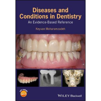 现货 牙科疾病与病症 循证参考文献 Diseases And Conditions In Dentistry 英文原版 Keyvan Moharamzadeh 中商原