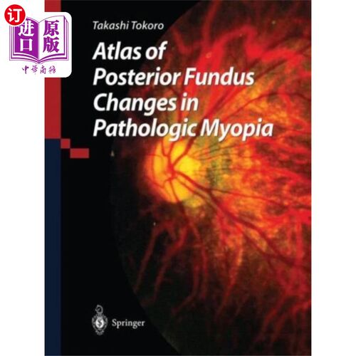 海外直订医药图书Atlas of Posterior Fundus Changes in Pathologic ... 病理性近视后眼底图谱的变化