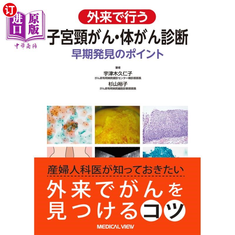海外直订日语 外来で行う子宮頸がん・体がん診断 早期発見のポイント 在门诊进行宫颈癌、体癌诊断的早期发现要点