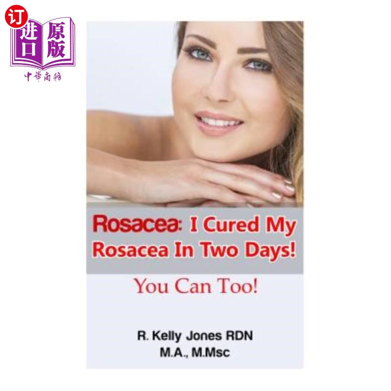 海外直订医药图书Rosacea: I Cured My Rosacea In Two Days! You Can Too! 酒渣鼻：我两天就治好了我的酒渣鼻！你也可以！