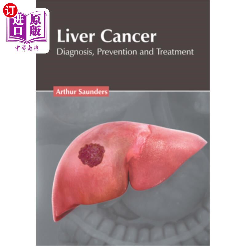 海外直订医药图书Liver Cancer: Diagnosis, Prevention and Treatment 肝癌的诊断、预防和治疗