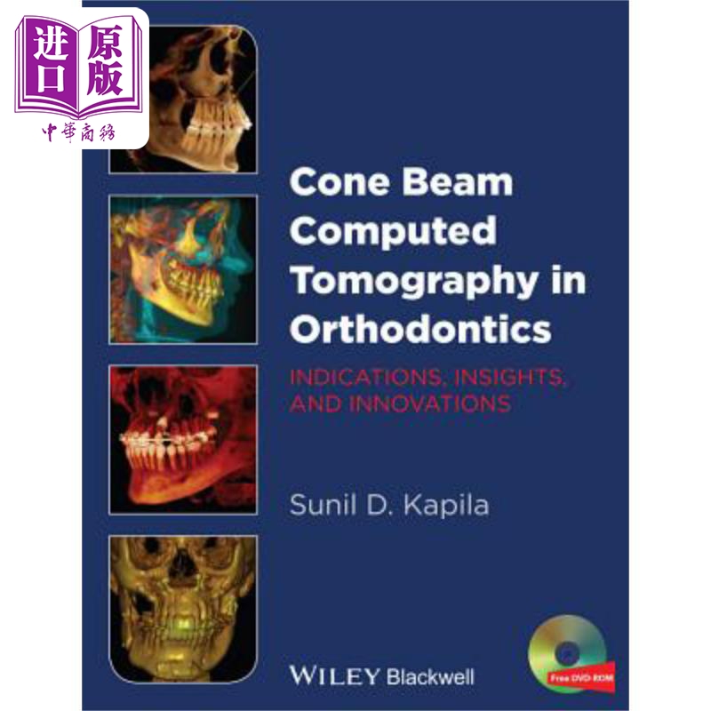 现货 正畸学中的锥束计算机断层扫描 适应症 见解和创新 Cone Beam Computed Tomography In Orthodontics 英� 书籍/杂志/报纸 科普读物/自然科学/技术类原版书 原图主图