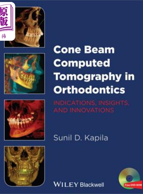 现货 正畸学中的锥束计算机断层扫描 适应症 见解和创新 Cone Beam Computed Tomography In Orthodontics 英�