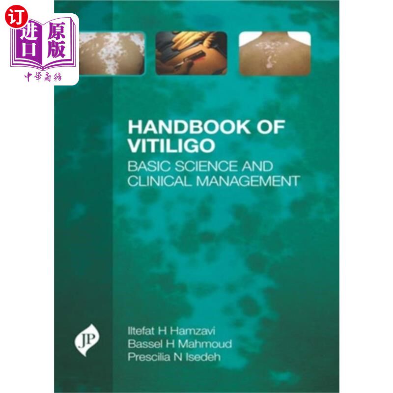 海外直订医药图书Handbook of Vitiligo 白癜风手册