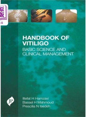 海外直订医药图书Handbook of Vitiligo 白癜风手册