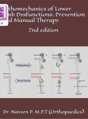 海外直订医药图书Pathomechanics of Lower Limb Dysfunctions: Prevention and Manual Therapy: 2nd ed 下肢功能障碍的病理