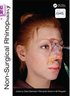 海外直订医药图书Non-Surgical Rhinoplasty 非手术鼻整形术