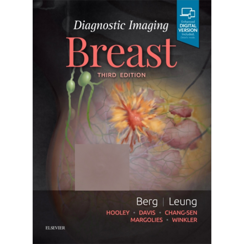 现货 诊断影像 乳房 第3版 英文原版 Diagnostic Imaging Breast Wendie A Berg Jessica Leung【中商原版】Elsevier 医学影像学