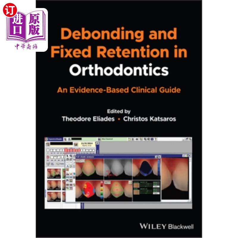 海外直订医药图书Debonding and Fixed Retention in Orthodontics: An Evidence-Based Clinical Guide 正畸中的脱粘和固定