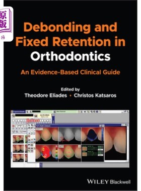 海外直订医药图书Debonding and Fixed Retention in Orthodontics: An Evidence-Based Clinical Guide 正畸中的脱粘和固定