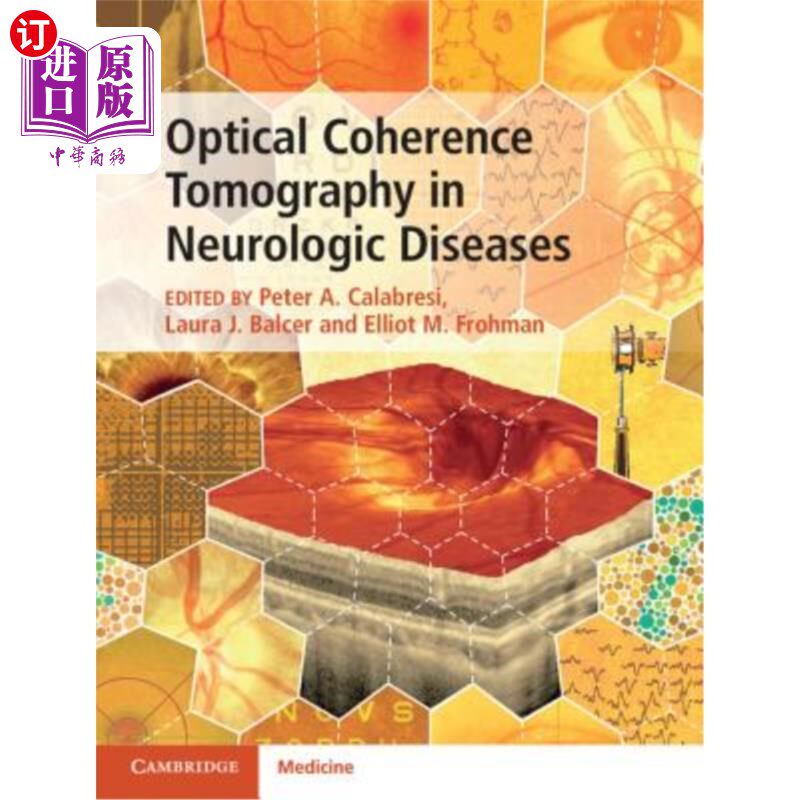 海外直订医药图书Optical Coherence Tomography in Neurologic Diseases 光学相干断层扫描在神经系统疾病中的应用
