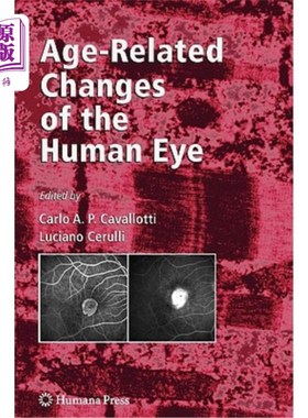 海外直订医药图书Age-Related Changes of the Human Eye 人眼年龄相关变化