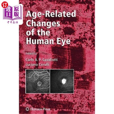 海外直订医药图书Age-Related Changes of the Human Eye 人眼年龄相关变化