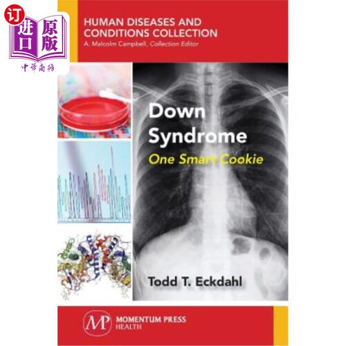 海外直订Down Syndrome: One Smart Cookie 唐氏综合症：一个智能饼干