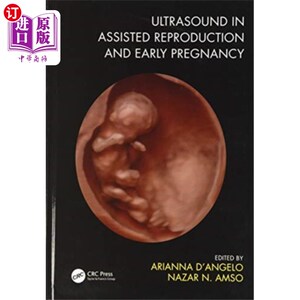 海外直订医药图书Ultrasound in Assisted Reproduction and Early Pr... 超声在辅助生殖和早期妊娠中的应用