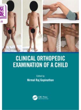 海外直订医药图书Clinical Orthopedic Examination of a Child 儿童临床骨科检查