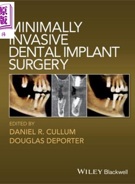 现货 微创种植牙手术 Minimally Invasive Dental Implant Surgery 英文原版 Daniel Cullum wiley 【中商原版】