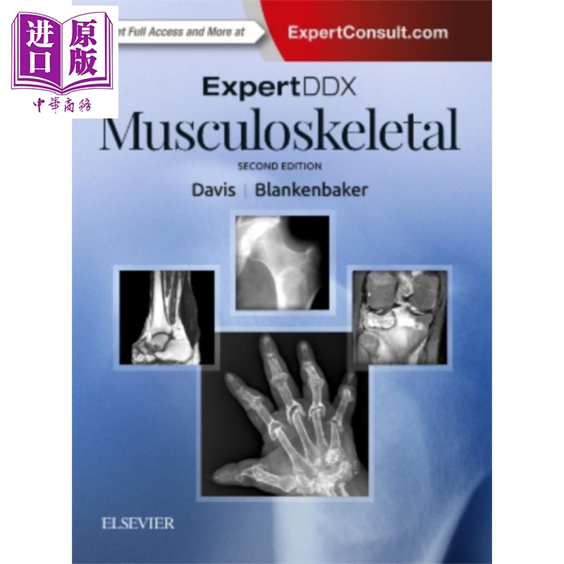 现货专家DDx肌肉骨骼第2版英文原版 ExpertDDx Musculoskeletal Kirkland Davis【中商原版】Elsevier