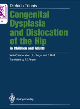 海外直订医药图书Congenital Dysplasia and Dislocation of the Hip in Children and Adults 儿童和成人先天性发育不良和髋