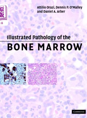 海外直订医药图书Illustrated Pathology of the Bone Marrow 骨髓病理学图解