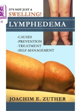 海外直订It's Not Just a Swelling! Lymphedema: Causes, Prevention, Treatment, Self-Manage 这不仅仅是肿胀!淋巴水肿:病