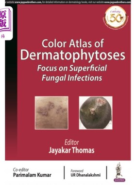 海外直订医药图书Color Atlas of Dermatophytoses 皮癣病彩色图集