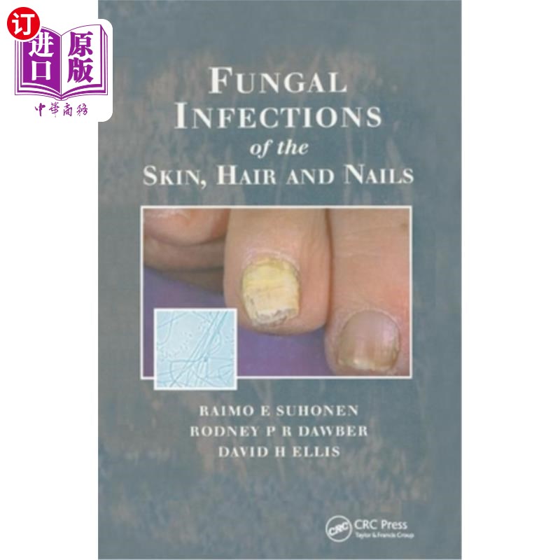 海外直订医药图书Fungal Infections of the Skin and Nails 皮肤和指甲的真菌感染