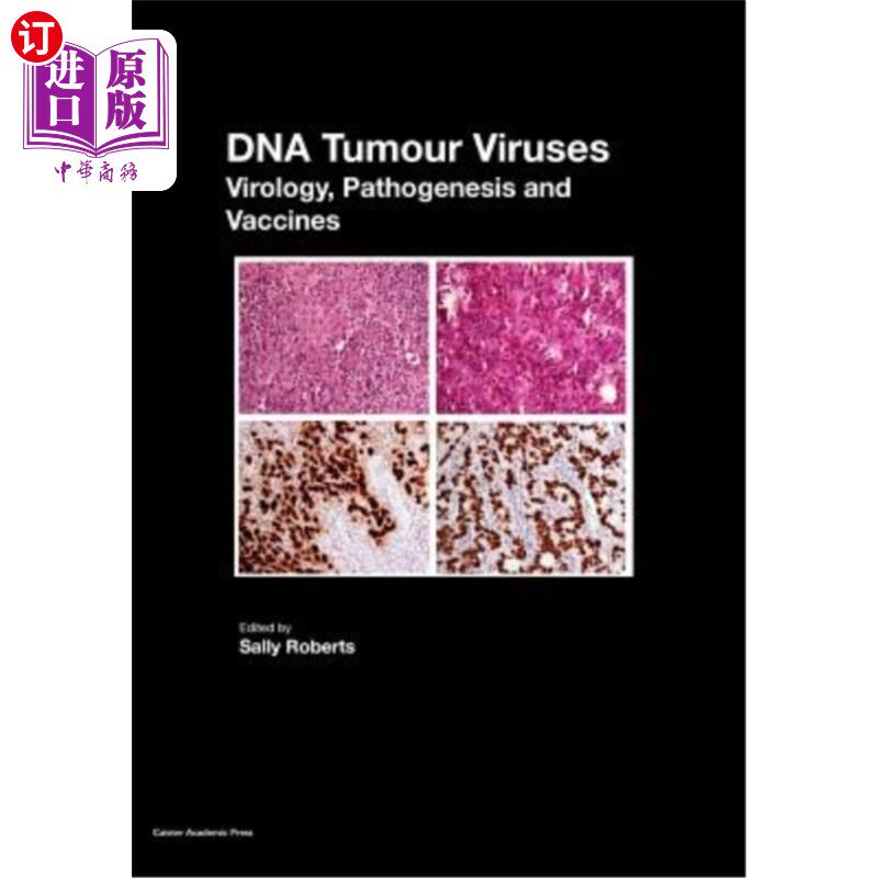 海外直订DNA Tumour Viruses: Virology, Pathogenesis and Vaccines DNA肿瘤病毒:病毒学，发病机理和疫苗