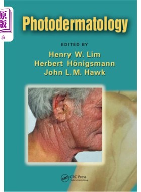 海外直订医药图书Photodermatology Photodermatology