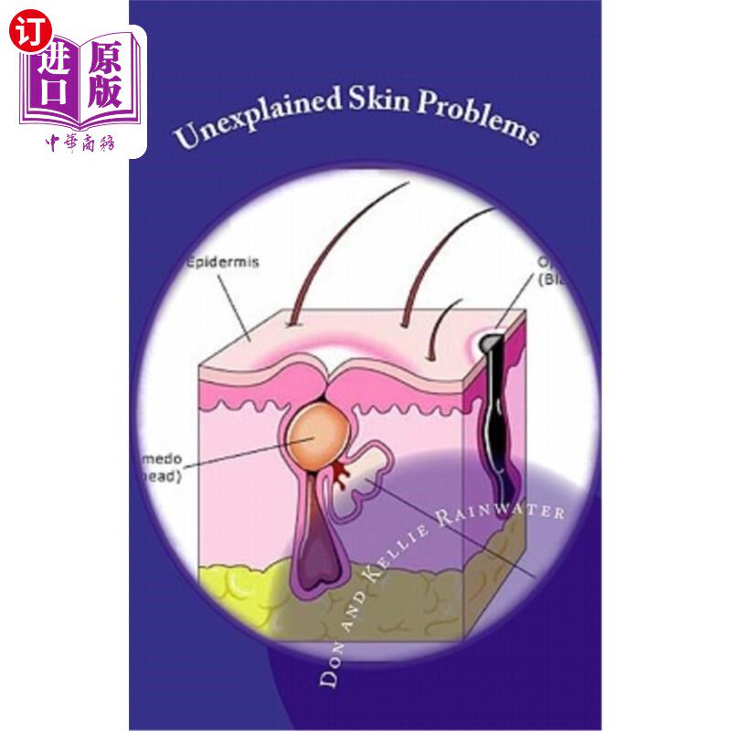海外直订医药图书Unexplained Skin Problems: Home Treatment And Precautions 无法解释的皮肤问题：家庭治疗和预防措施