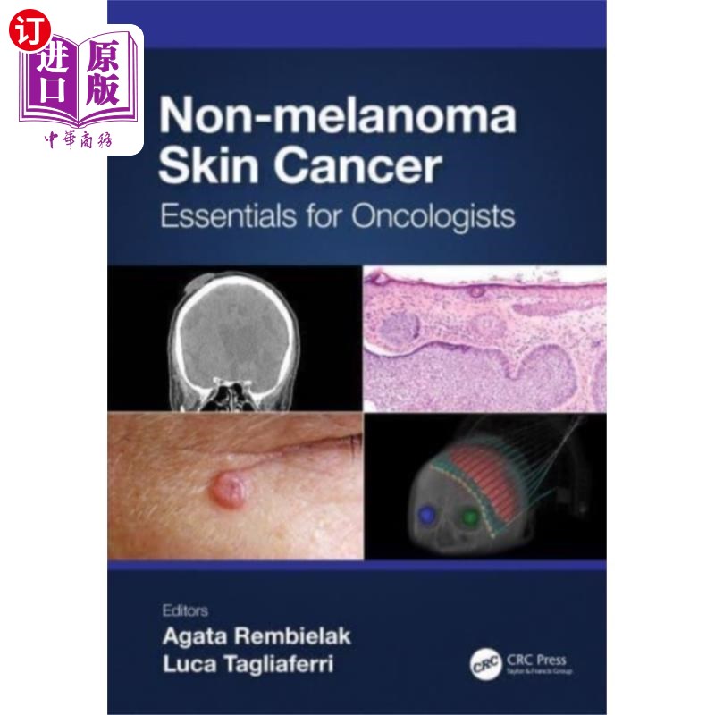 海外直订医药图书Non-melanoma Skin Cancer 非黑色素瘤皮肤癌