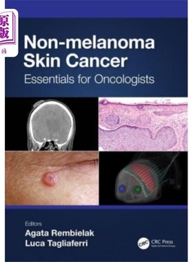 海外直订医药图书Non-melanoma Skin Cancer 非黑色素瘤皮肤癌