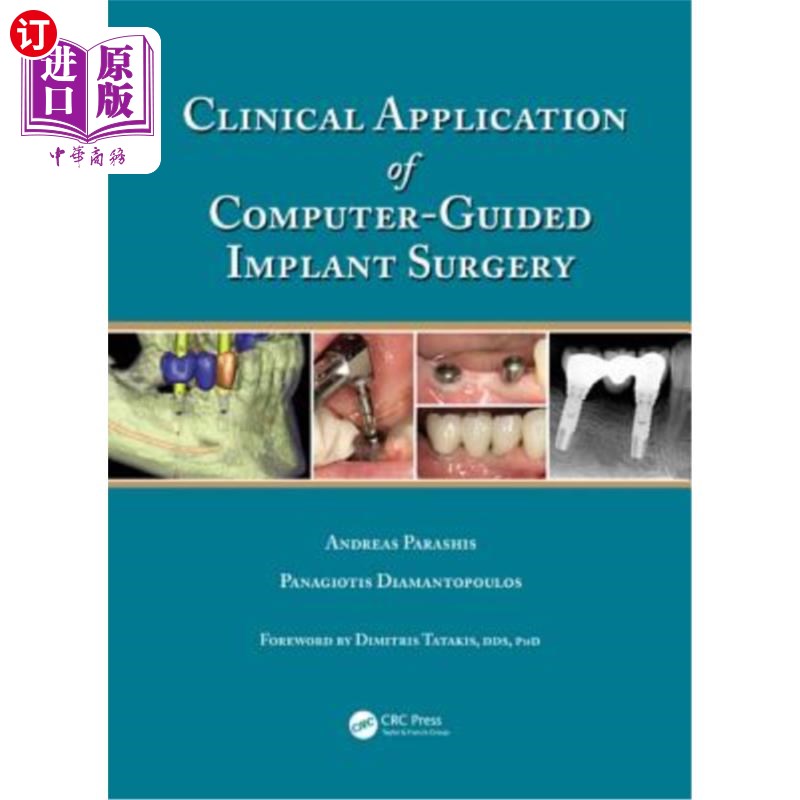 海外直订医药图书Clinical Application of Computer-Guided Implant Surgery 计算机引导种植体手术的临床应用