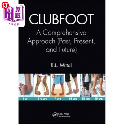 海外直订医药图书Clubfoot: A Comprehensive Approach (Past, Present, and Future) 畸形足:一个综合的方法(过去、现在和未