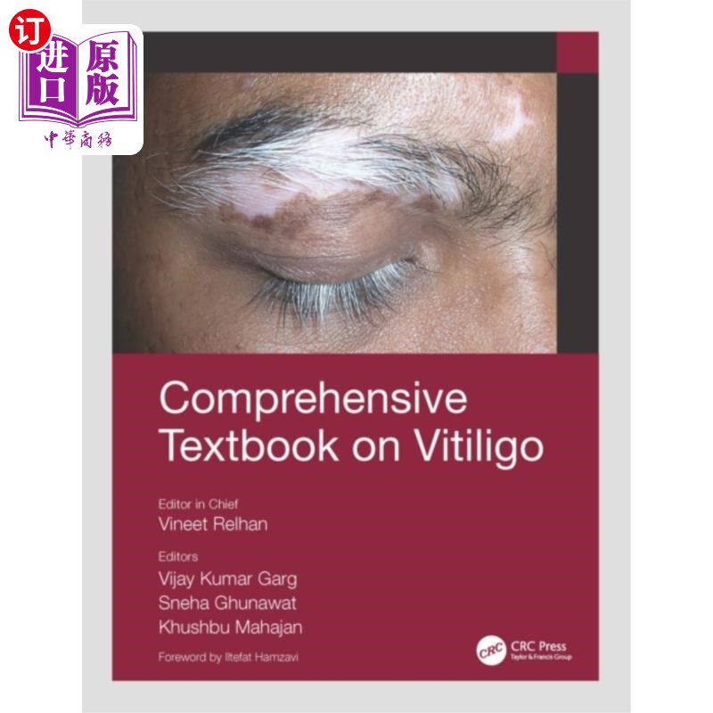 海外直订医药图书Comprehensive Textbook on Vitiligo 白癜风综合教材