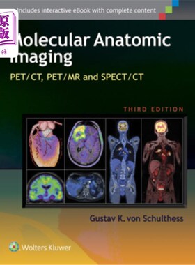 海外直订医药图书Molecular Anatomic Imaging: Pet/Ct, Pet/MR and Spect CT 分子解剖成像:Pet/Ct, Pet/MR和Spect Ct