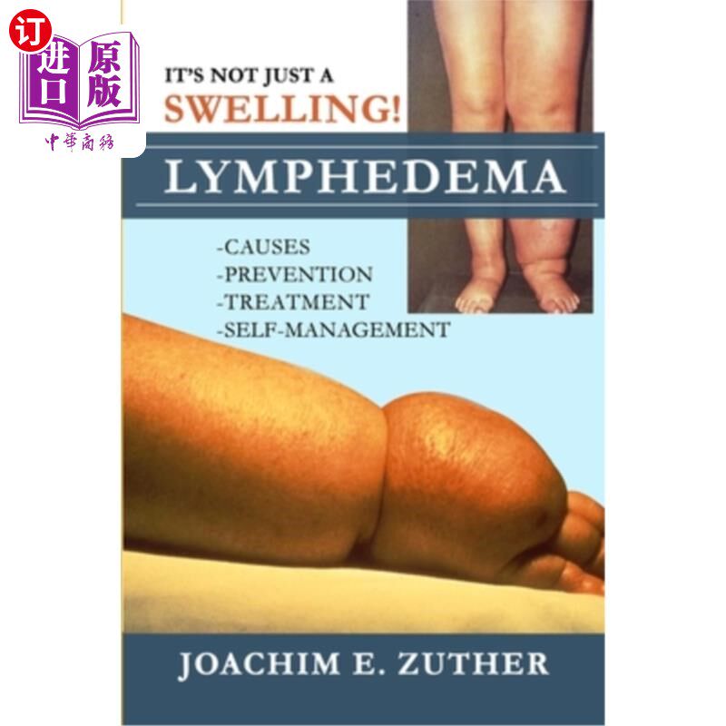 海外直订It's Not Just a Swelling! Lymphedema: Causes, Prevention, Treatment, Self-Manage 这不仅仅是肿胀!淋巴水肿:病