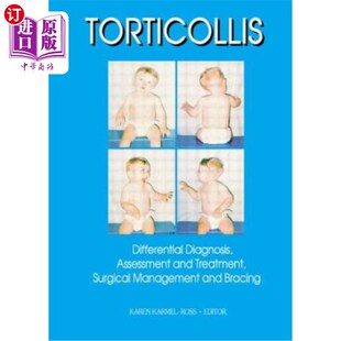 海外直订医药图书Torticollis: Differential Diagnosis, Assessment and Treatment, Surgical Manageme 斜颈：鉴别诊断、评
