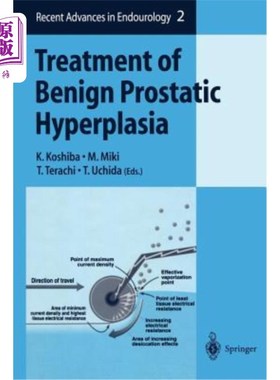 海外直订医药图书Treatment of Benign Prostatic Hyperplasia 良性前列腺增生症的治疗