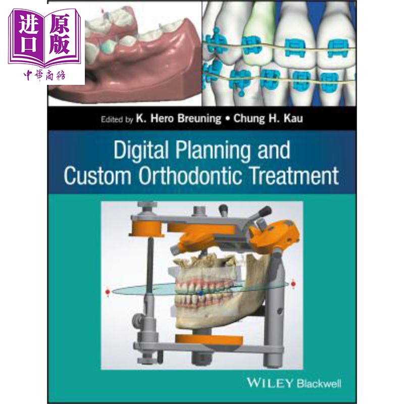 数字化设计与个性正畸治疗 Digital Planning And Custom Orthodontic Treatment 英文原版 K Hero Breuning  wiley【中商原?