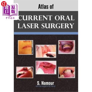 Surgery Current Laser 口腔激光手术现状图集 Oral 海外直订医药图书Atlas