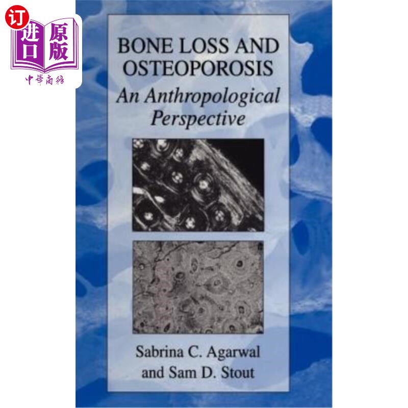 海外直订Bone Loss and Osteoporosis: An Anthropological Perspective 骨质流失与骨质疏松症：人类学视角