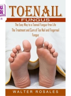 海外直订医药图书Toenail Fungus: The Easy Way to a Toenail Fungus-free Life (The Treatment and Cu 趾甲真菌:无趾甲真