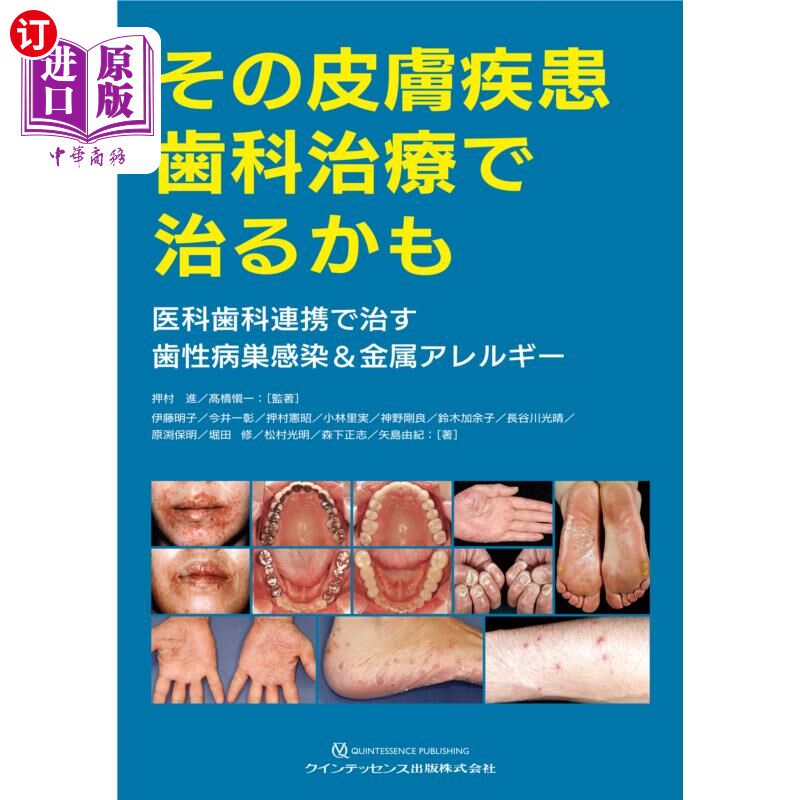 海外直订日语 その皮膚疾患歯科治療で治るかも 医科歯科連携で治す歯性病巣感染&金属アレルギー 用牙科治疗治疗那个皮肤