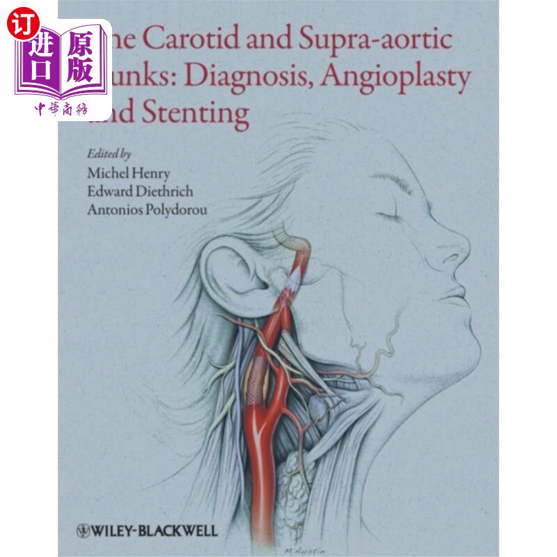 海外直订医药图书Carotid and Supra-Aortic Trunks - Diagnosis, Angioplasty and Stenting 颈动脉和主动脉上干