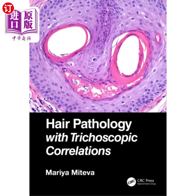 海外直订医药图书Hair Pathology with Trichoscopic Correlations 毛发病理学与毛发镜相关性